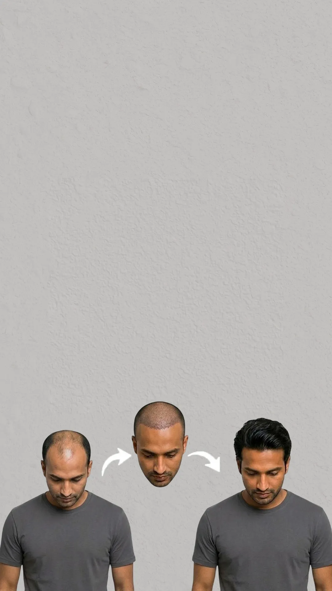 Hair Transplant Clinic